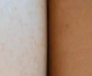 Conclusión
